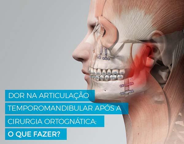 Dor na Articulação Temporomandibular (ATM) após a cirurgia ortognática. O que fazer?