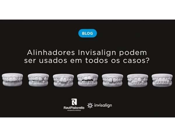 Alinhadores Invisalign podem ser usados em todos os casos?